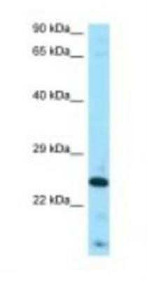 Western Blot: FGF-8 Antibody [NBP1-98443]