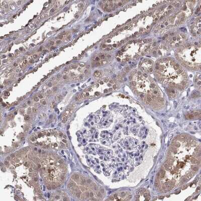 Immunohistochemistry-Paraffin: FGF-9 Antibody [NBP2-62653]