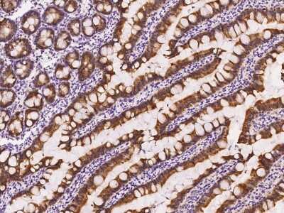Immunohistochemistry-Paraffin: FGF-9 Antibody [NBP2-99548]