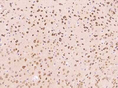 Immunohistochemistry-Paraffin: FGF-9 Antibody [NBP2-99548]