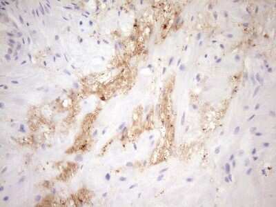 Immunohistochemistry-Paraffin: FGF-BP Antibody (OTI2B6) [NBP2-45643]