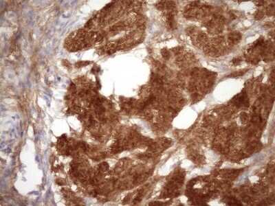 Immunohistochemistry: FGF-BP Antibody (OTI2B6) - Azide and BSA Free [NBP2-71527]