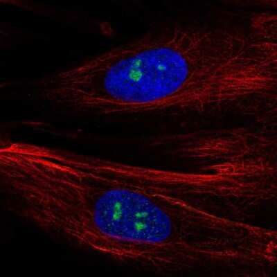 Immunocytochemistry/ Immunofluorescence: FGFR1 Antibody [NBP2-56354]