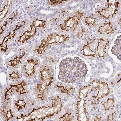 Immunohistochemistry-Paraffin: FGFR1 Antibody [NBP2-33784]