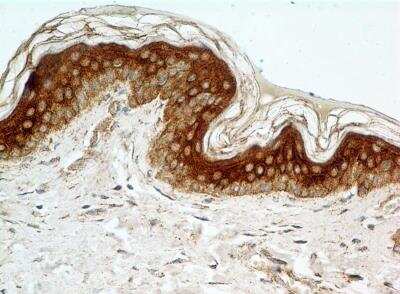Immunohistochemistry-Paraffin: FGFR1 Antibody (M17A3) - BSA Free [NB100-2079]