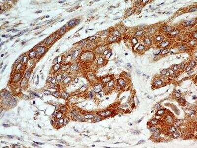 Immunohistochemistry-Paraffin: FGFR1 Antibody (M17D10) - BSA Free [NB100-2080]