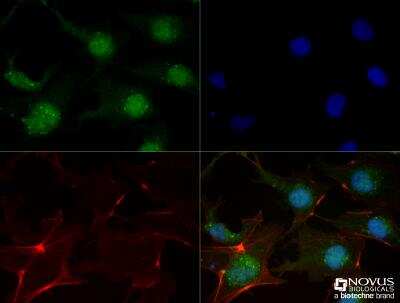 Immunocytochemistry/ Immunofluorescence: FGFR1 Antibody (M2F12) - BSA Free [NB120-829]