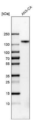 Western Blot: FGFR1 Antibody [NBP2-33784]