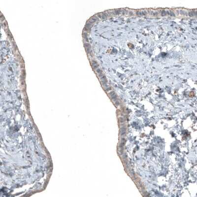 Immunohistochemistry-Paraffin: FGFR2 Antibody [NBP1-88670]