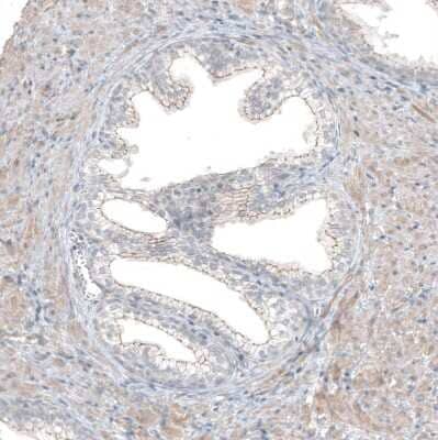 Immunohistochemistry-Paraffin: FGFR2 Antibody [NBP1-88670]