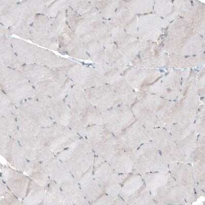 Immunohistochemistry-Paraffin: FGFR2 Antibody [NBP1-88670]
