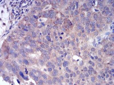 Immunohistochemistry: FGFR3 Antibody (2H10B4) - BSA Free [NBP2-52468]