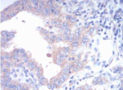 Immunohistochemistry-Paraffin: FGFR3 Antibody (2H10B4) - BSA Free [NBP2-52468]