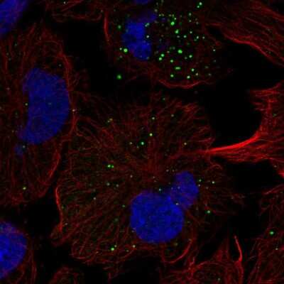 Immunocytochemistry/ Immunofluorescence: FGFR5/FGFRL1 Antibody [NBP2-56879]