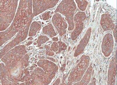 Immunohistochemistry-Paraffin: FGFR5/FGFRL1 Antibody [NBP1-31461]