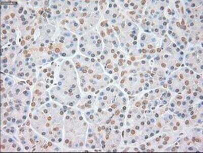 Immunohistochemistry-Paraffin: FGF basic/FGF2/bFGF Antibody (OTI3D9) [NBP1-47749]