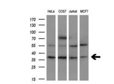 Western Blot: FGF basic/FGF2/bFGF Antibody (OTI3D9) [NBP1-47749]