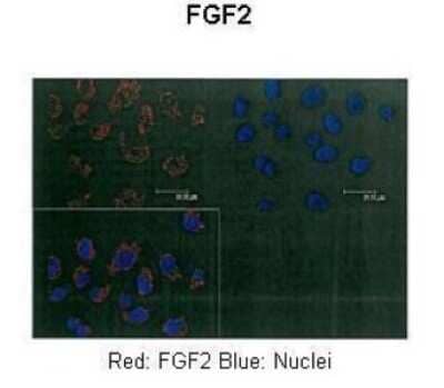 Immunohistochemistry: FGF basic/FGF2/bFGF Antibody [NBP1-57096]