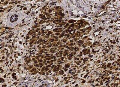 Immunohistochemistry-Paraffin: FGF basic/FGF2/bFGF Antibody (013) [NBP2-89192]