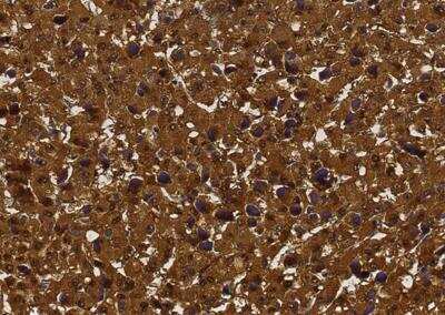 Immunohistochemistry-Paraffin: FGF basic/FGF2/bFGF Antibody (013) [NBP2-89192]