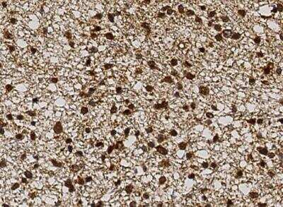 Immunohistochemistry-Paraffin: FGF basic/FGF2/bFGF Antibody (013) [NBP2-89192]