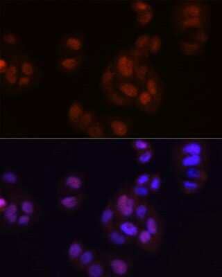 Immunocytochemistry/ Immunofluorescence: FGF basic/FGF2/bFGF Antibody (8W6M5) [NBP3-15367]