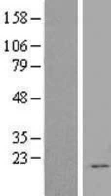 Western Blot: FGF-12 Overexpression Lysate [NBL1-10688]