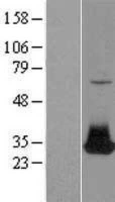 Western Blot: FGF-12 Overexpression Lysate [NBP2-06579]