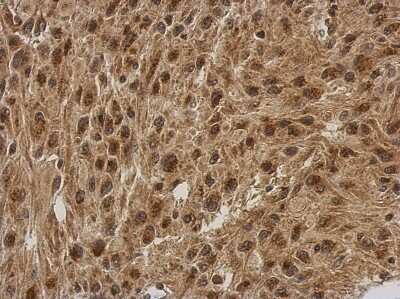 Immunohistochemistry-Paraffin: FGF-13 Antibody [NBP2-16471]