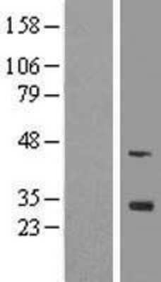 Western Blot: FGF-13 Overexpression Lysate [NBL1-10689]