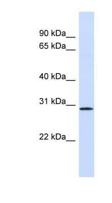 Western Blot: FGF14 Antibody [NBP1-69006]