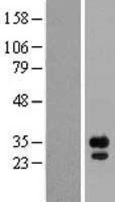 Western Blot: FGF14 Overexpression Lysate [NBP2-05047]