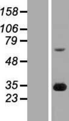 Western Blot: FGF14 Overexpression Lysate [NBP2-07910]