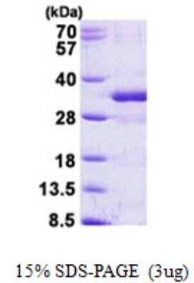 SDS-PAGE: Recombinant Human FGF14 His Protein [NBP2-23050]