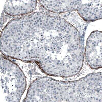 Immunohistochemistry-Paraffin: FGF18 Antibody (CL7628) [NBP2-88869]