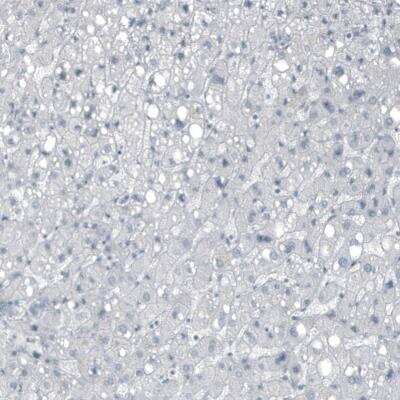 Immunohistochemistry-Paraffin: FGF18 Antibody (CL7628) [NBP2-88869]