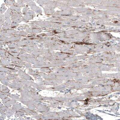 Immunohistochemistry-Paraffin: FGF18 Antibody (CL7628) [NBP2-88869]