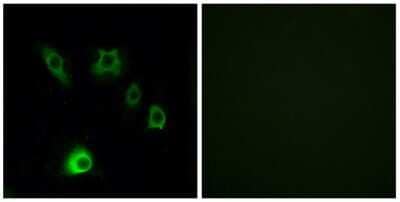 Immunocytochemistry/ Immunofluorescence: FGF18 Antibody [NBP3-06688]