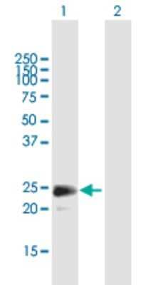 Western Blot: FGF18 Antibody [H00008817-B01P]