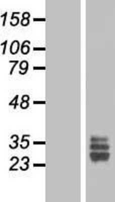 Western Blot: FGF18 Overexpression Lysate [NBL1-10692]