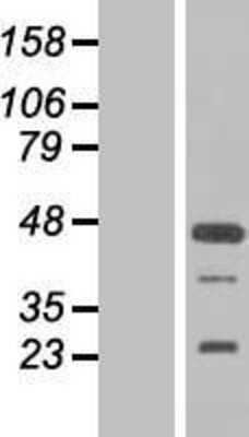 Western Blot: FGF-19 Overexpression Lysate [NBL1-10693]