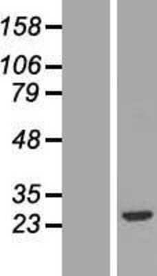 Western Blot: FGF-20 Overexpression Lysate [NBP2-06709]