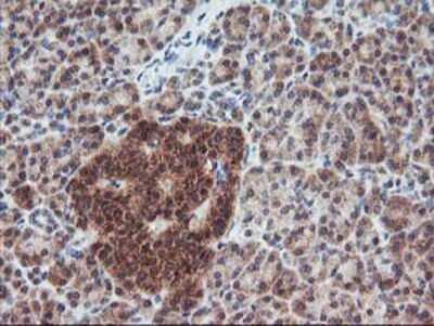Immunohistochemistry-Paraffin: FGF-21 Antibody (OTI2F10) [NBP2-00645]