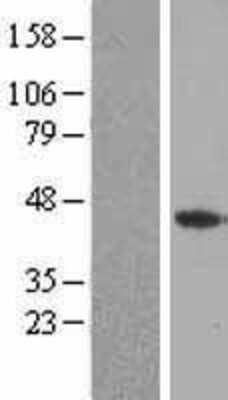 Western Blot: FGF-4 Overexpression Lysate [NBP2-08157]