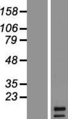 Western Blot: FGF-5 Overexpression Lysate [NBP2-05915]