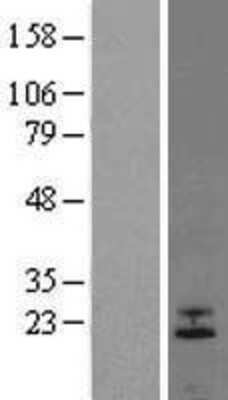 Western Blot: FGF-6 Overexpression Lysate [NBL1-10699]