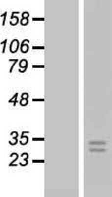 Western Blot: FGF-8 Overexpression Lysate [NBP2-05908]