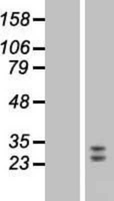 Western Blot: FGF-9 Overexpression Lysate [NBP2-08156]