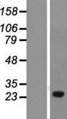 Western Blot: FGF-BP Overexpression Lysate [NBP2-07785]