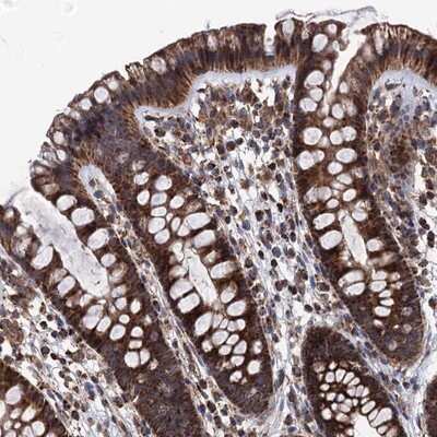 Immunohistochemistry-Paraffin: FGFBP2 Antibody [NBP1-81341]